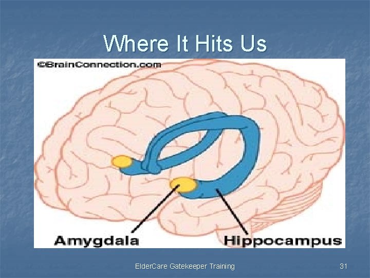 Where It Hits Us Elder. Care Gatekeeper Training 31 