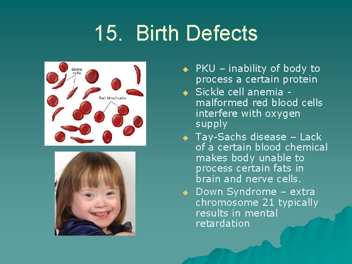 15. Birth Defects u u PKU – inability of body to process a certain