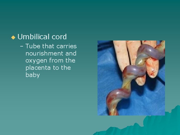 u Umbilical cord – Tube that carries nourishment and oxygen from the placenta to