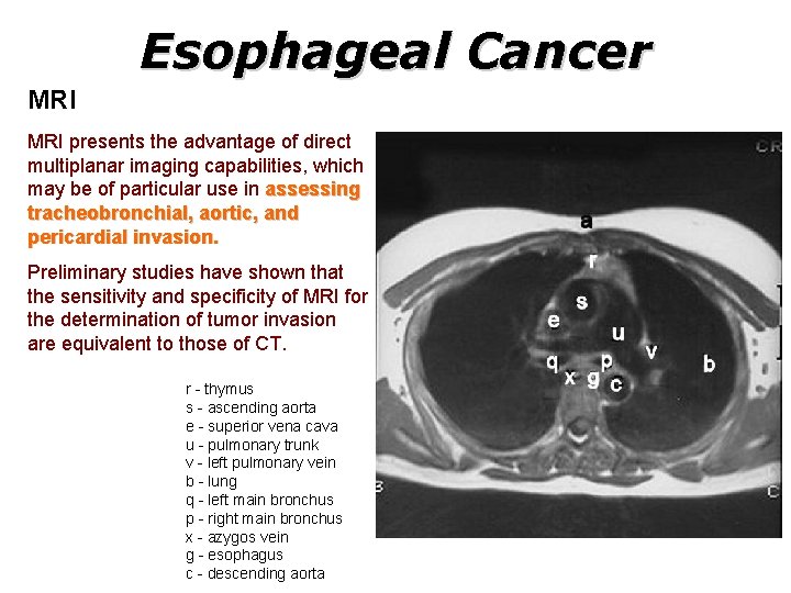 Esophageal Cancer MRI presents the advantage of direct multiplanar imaging capabilities, which may be