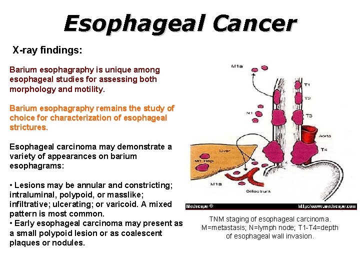 Esophageal Cancer X-ray findings: Barium esophagraphy is unique among esophageal studies for assessing both