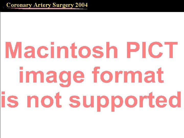 Coronary Artery Surgery 2004 Outcome according to number of diseased vessels (237 conversion CABG