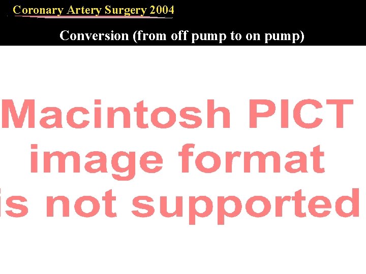 Coronary Artery Surgery 2004 Conversion (from off pump to on pump) 