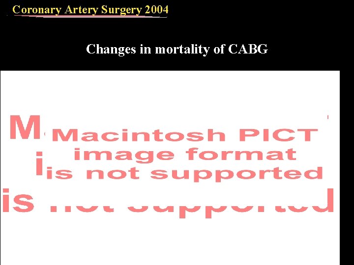 Coronary Artery Surgery 2004 Changes in mortality of CABG 