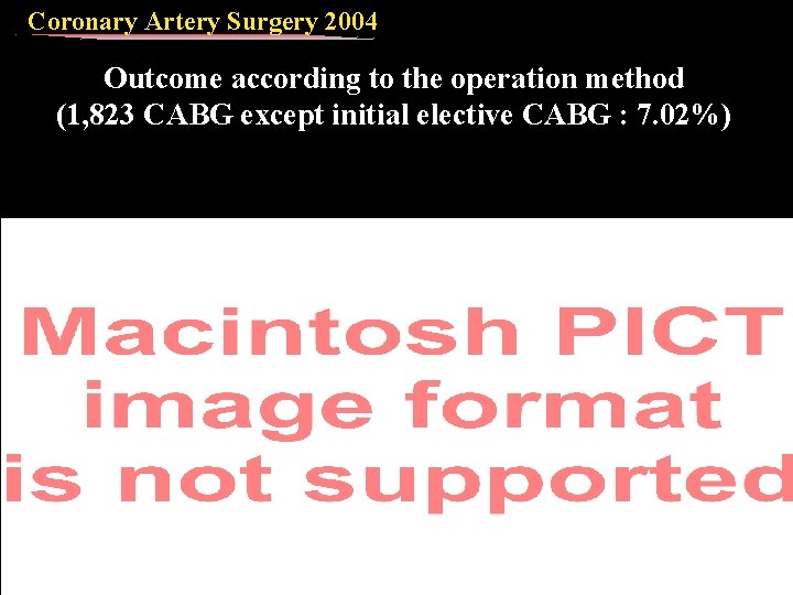 Coronary Artery Surgery 2004 Outcome according to the operation method (1, 823 CABG except