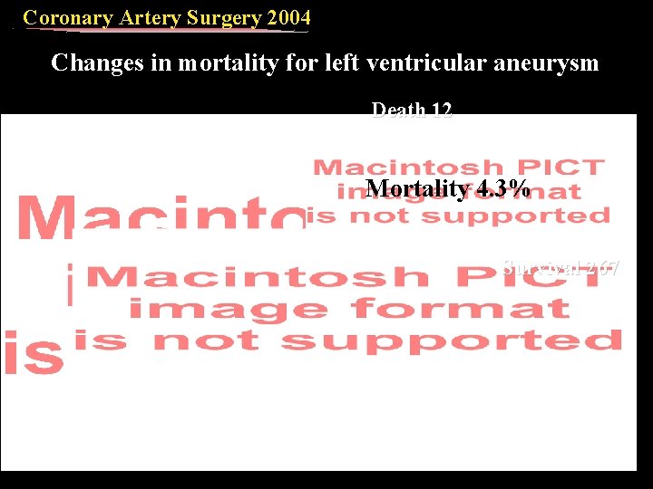 Coronary Artery Surgery 2004 Changes in mortality for left ventricular aneurysm Death 12 Mortality