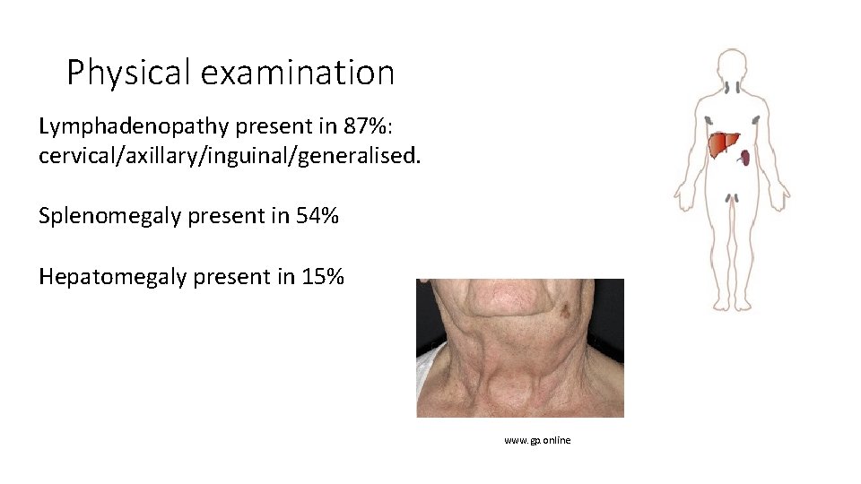 Physical examination Lymphadenopathy present in 87%: cervical/axillary/inguinal/generalised. Splenomegaly present in 54% Hepatomegaly present in