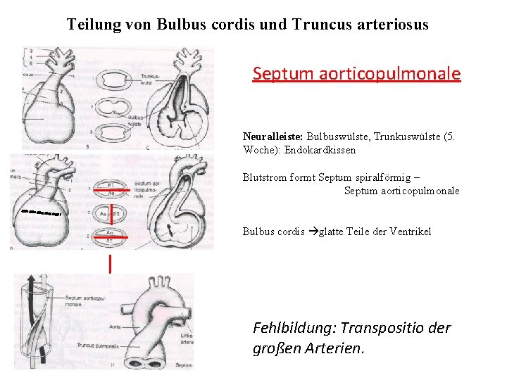 Teilung von Bulbus cordis und Truncus arteriosus Septum aorticopulmonale Neuralleiste: Bulbuswülste, Trunkuswülste (5. Woche):