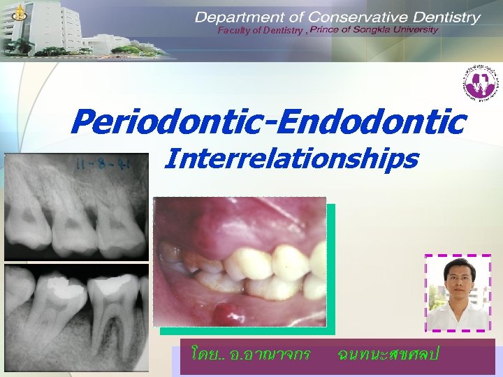 Faculty of Dentistry , Periodontic-Endodontic Interrelationships โดย. . อ. อาณาจกร ฉนทนะสขศลป 