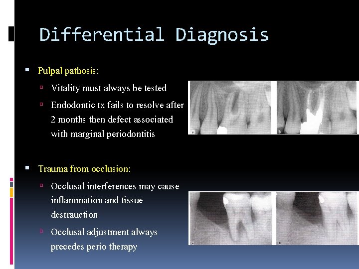 Differential Diagnosis Pulpal pathosis: Vitality must always be tested Endodontic tx fails to resolve