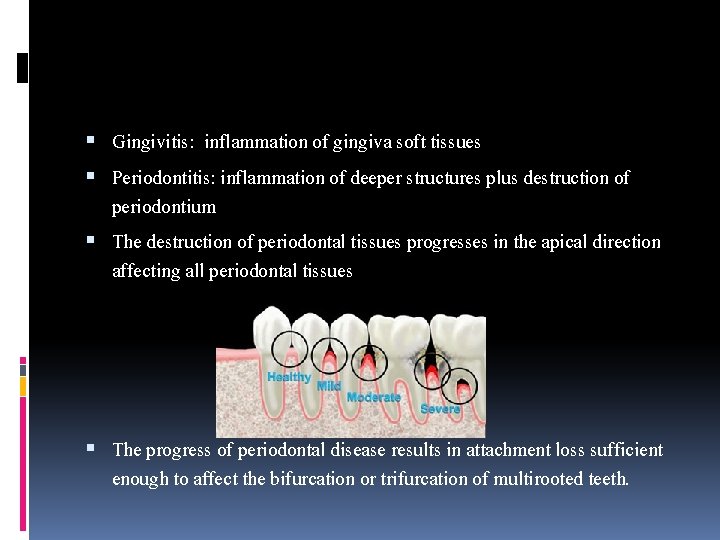  Gingivitis: inflammation of gingiva soft tissues Periodontitis: inflammation of deeper structures plus destruction