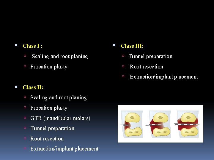  Class I : Scaling and root planing Furcation plasty Class II: Scaling and