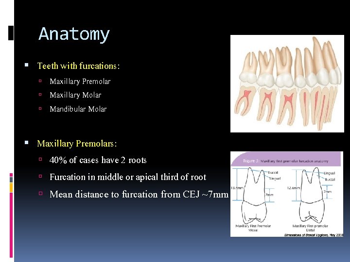 Anatomy Teeth with furcations: Maxillary Premolar Maxillary Molar Mandibular Molar Maxillary Premolars: 40% of