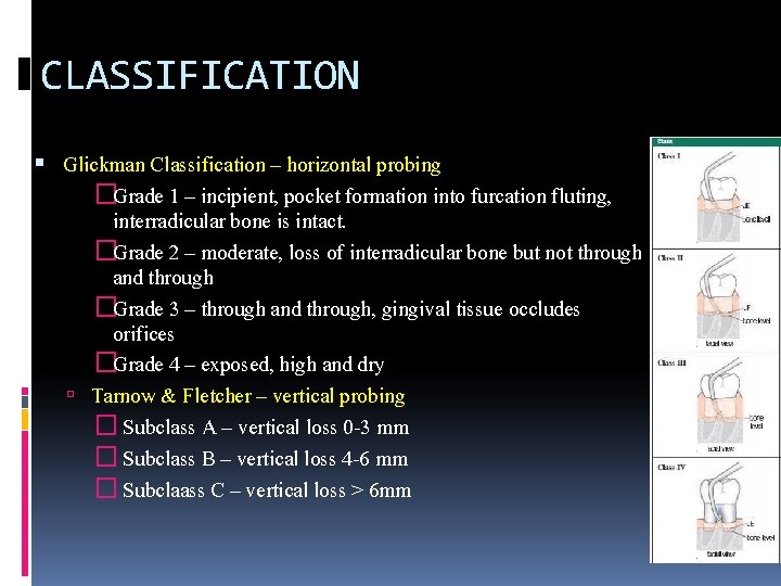 CLASSIFICATION Glickman Classification – horizontal probing �Grade 1 – incipient, pocket formation into furcation