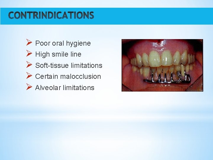 Ø Poor oral hygiene Ø High smile line Ø Soft-tissue limitations Ø Certain malocclusion