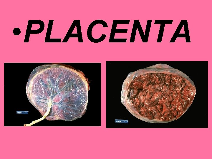  • PLACENTA 