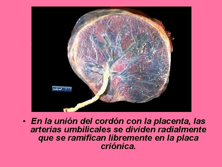  • En la unión del cordón con la placenta, las arterias umbilicales se