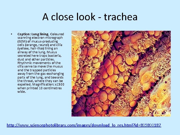 A close look - trachea • Caption: Lung lining. Coloured scanning electron micrograph (SEM)