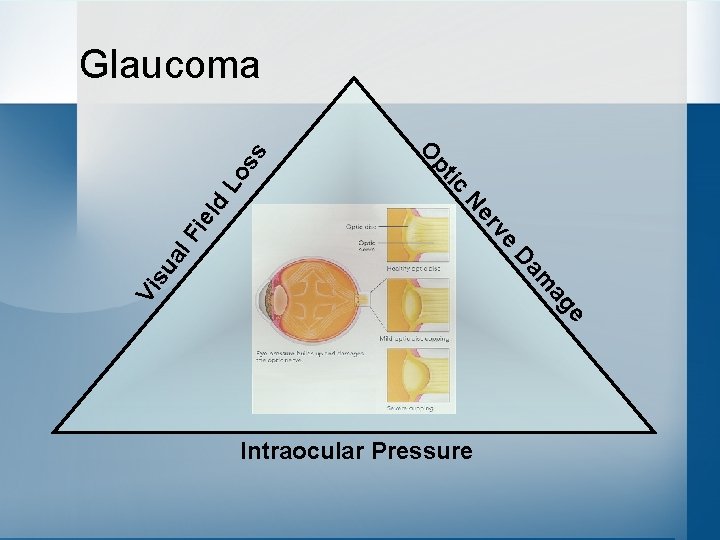 e ag m L ld ie Vi s ua Da e v er l