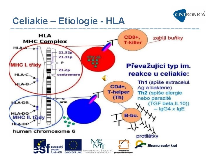 Celiakie – Etiologie - HLA 