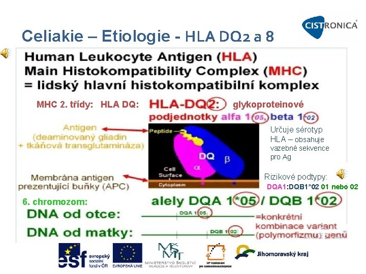 Celiakie – Etiologie - HLA DQ 2 a 8 MHC 2. třídy: HLA DQ: