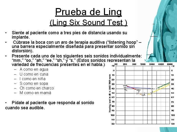 Prueba de Ling (Ling Six Sound Test ) • • • Siente al paciente