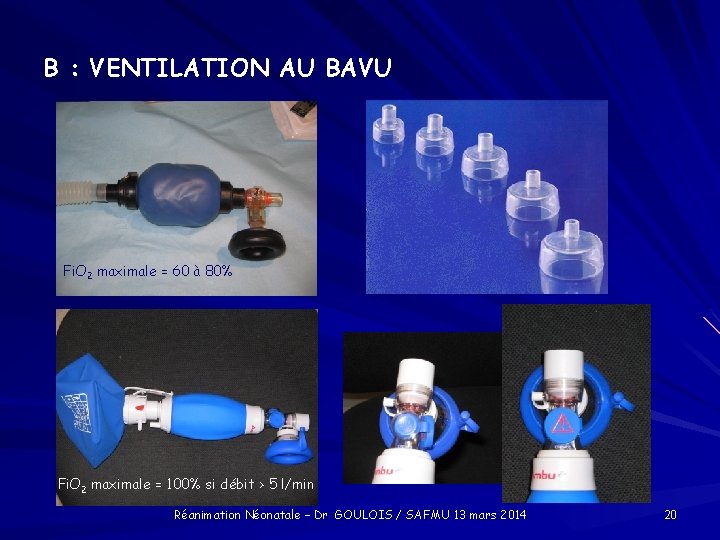 B : VENTILATION AU BAVU Fi. O 2 maximale = 60 à 80% Fi.
