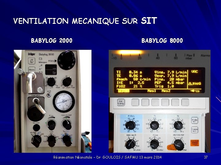 VENTILATION MECANIQUE SUR SIT BABYLOG 2000 BABYLOG 8000 Réanimation Néonatale – Dr GOULOIS /