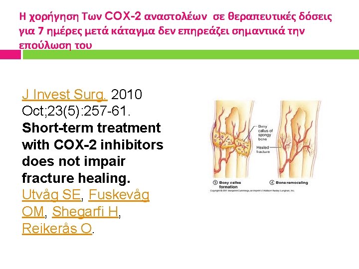 Η χορήγηση Των COX-2 αναστολέων σε θεραπευτικές δόσεις για 7 ημέρες μετά κάταγμα δεν