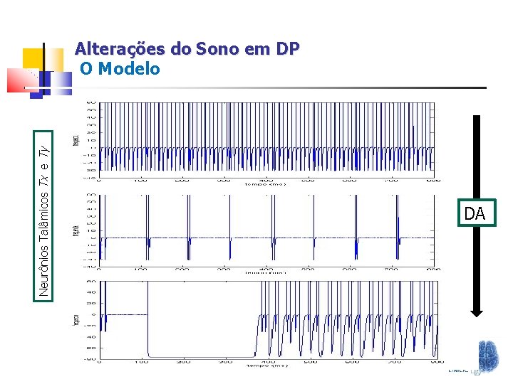 Neurônios Talâmicos Tx e Ty Alterações do Sono em DP O Modelo DA 