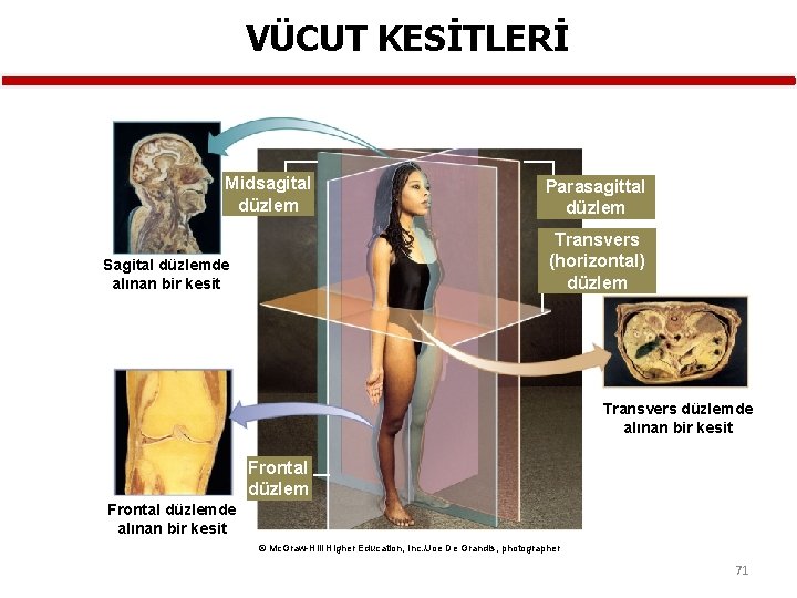 VÜCUT KESİTLERİ Midsagital düzlem Parasagittal düzlem Transvers (horizontal) düzlem Sagital düzlemde alınan bir kesit