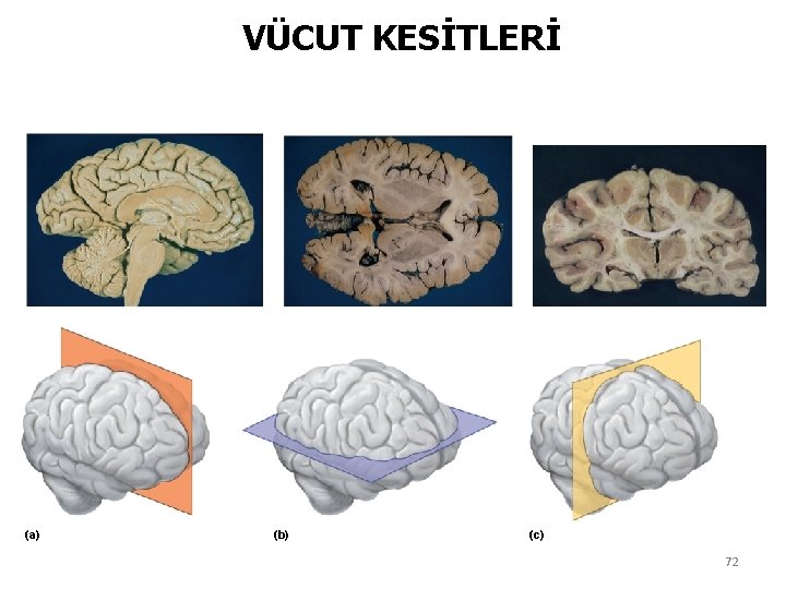 VÜCUT KESİTLERİ (a) (b) (c) 72 