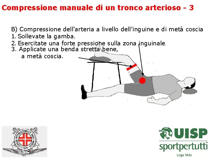 Compressione manuale di un tronco arterioso - 3 B) Compressione dell'arteria a livello dell'inguine