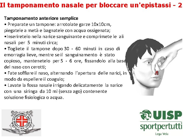 Il tamponamento nasale per bloccare un'epistassi - 2 Tamponamento anteriore semplice • Preparate un