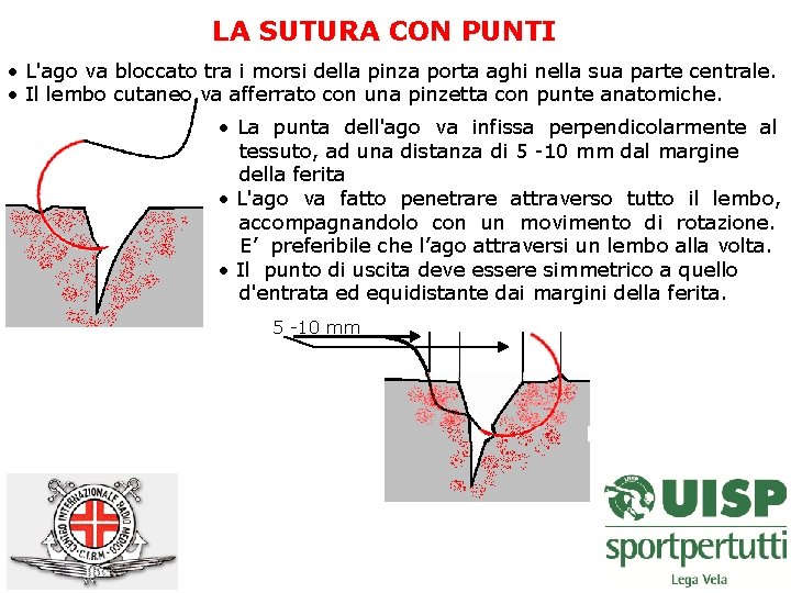 LA SUTURA CON PUNTI • L'ago va bloccato tra i morsi della pinza porta