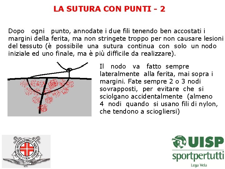 LA SUTURA CON PUNTI - 2 Dopo ogni punto, annodate i due fili tenendo