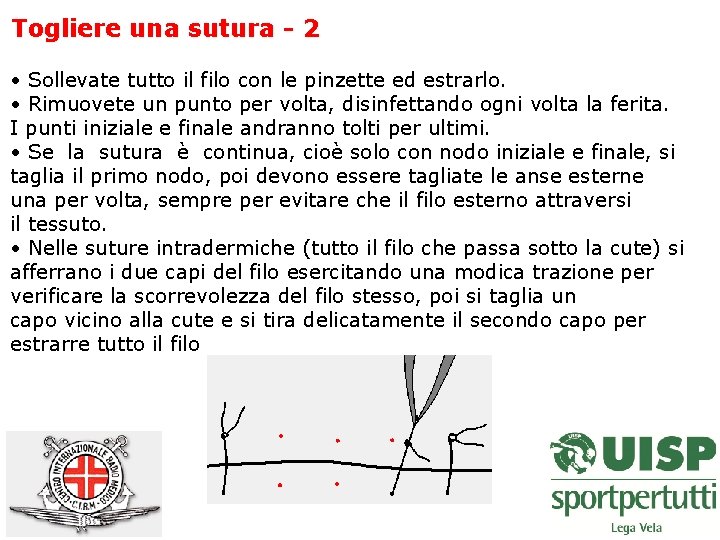 Togliere una sutura - 2 • Sollevate tutto il filo con le pinzette ed