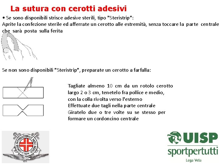 La sutura con cerotti adesivi • Se sono disponibili strisce adesive sterili, tipo "Steristrip":