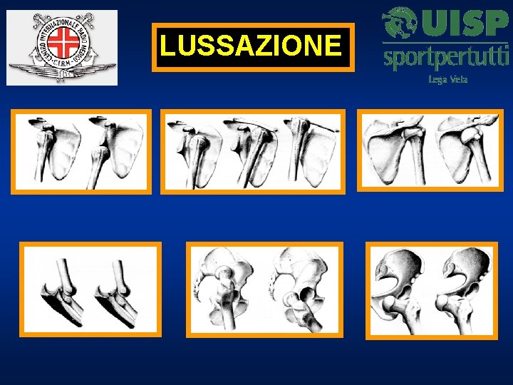 LUSSAZIONE 