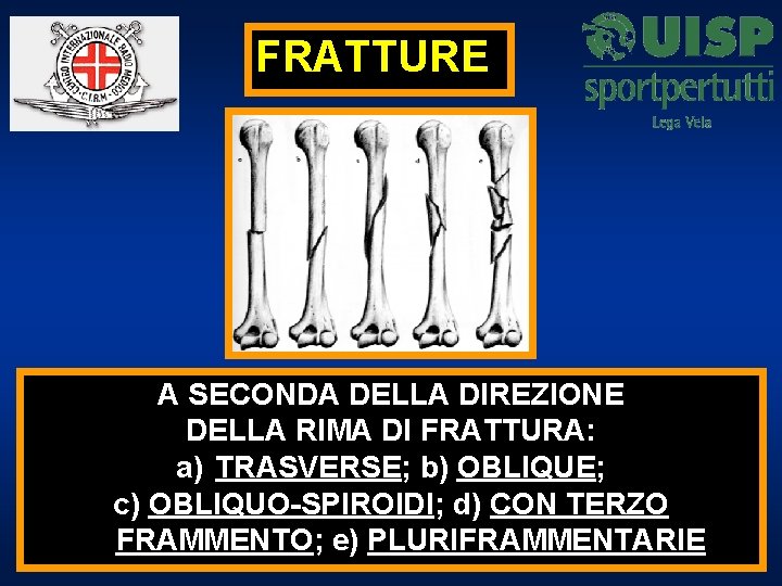 FRATTURE A SECONDA DELLA DIREZIONE DELLA RIMA DI FRATTURA: a) TRASVERSE; b) OBLIQUE; c)