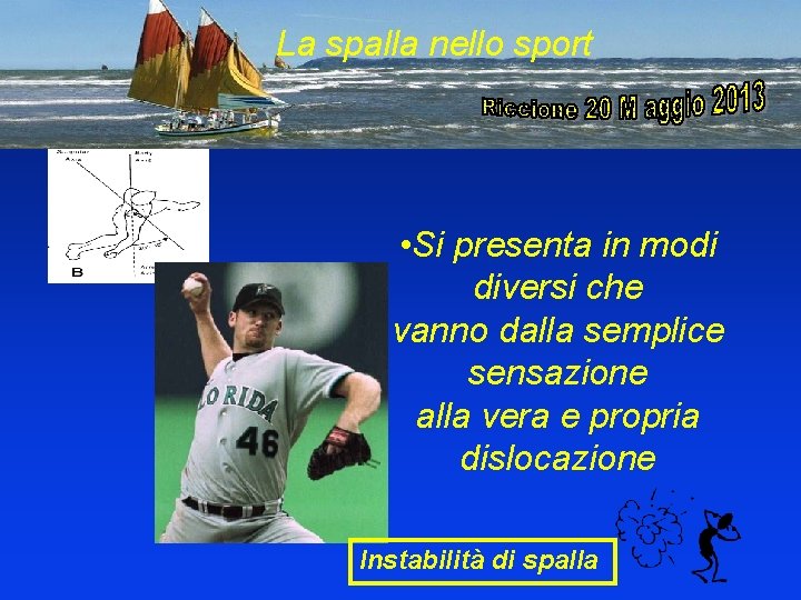 La spalla nello sport • Si presenta in modi diversi che vanno dalla semplice