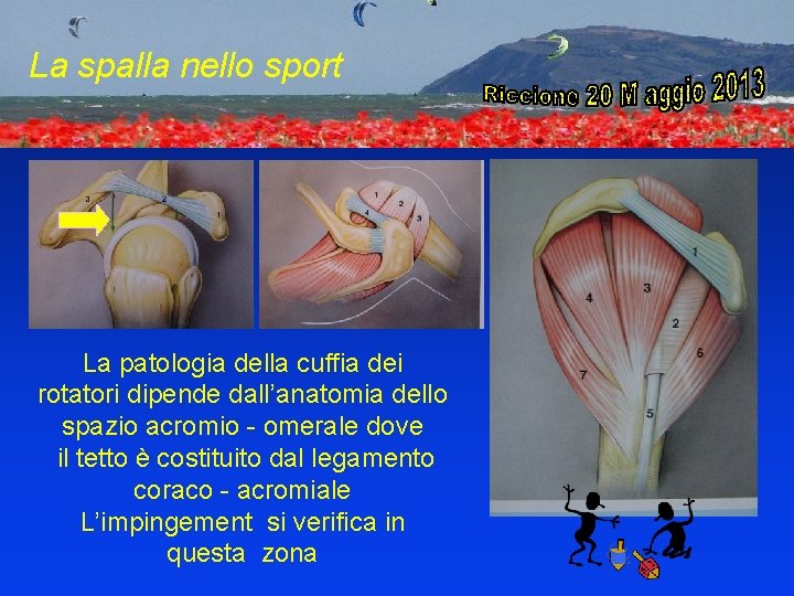 La spalla nello sport La patologia della cuffia dei rotatori dipende dall’anatomia dello spazio