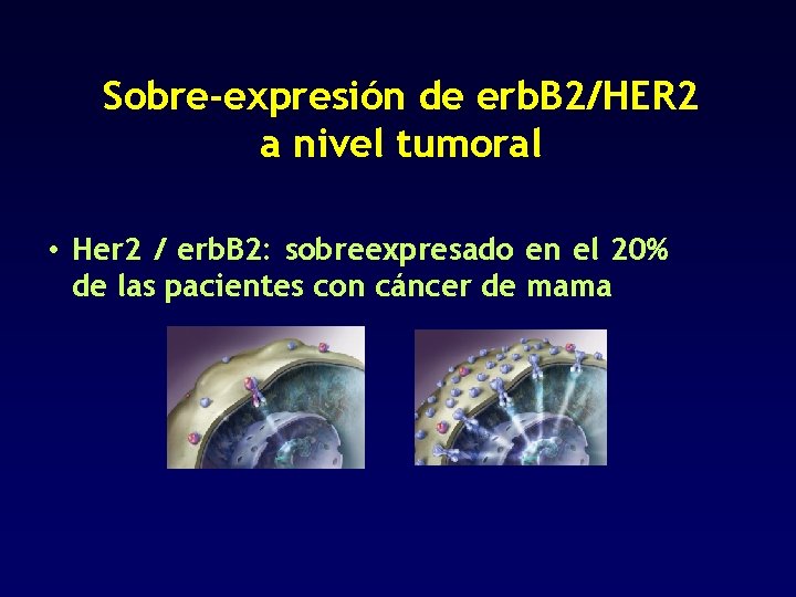Sobre-expresión de erb. B 2/HER 2 a nivel tumoral • Her 2 / erb.