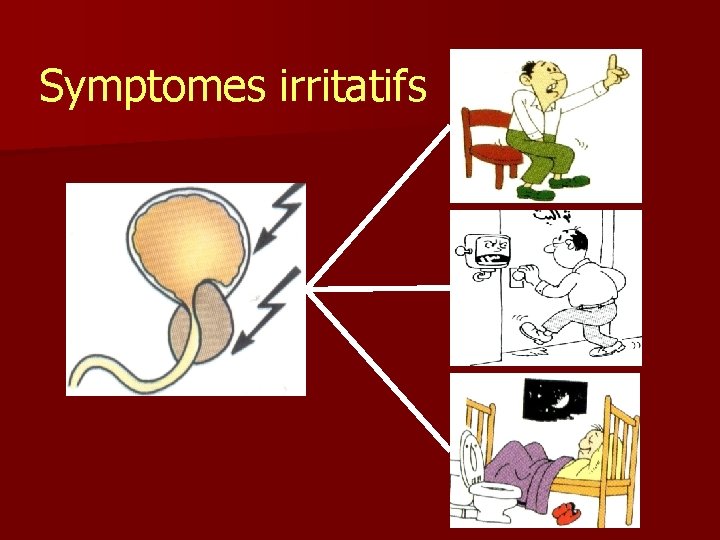 Symptomes irritatifs 