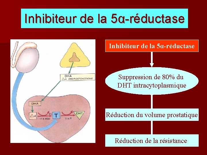 Inhibiteur de la 5α-réductase Suppression de 80% du DHT intracytoplasmique Réduction du volume prostatique