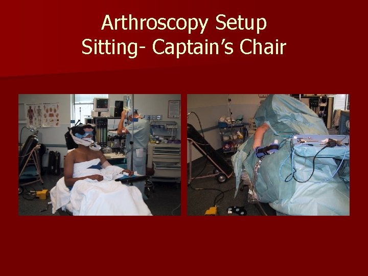 Arthroscopy Setup Sitting- Captain’s Chair 