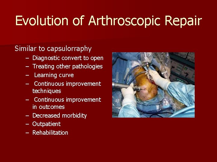 Evolution of Arthroscopic Repair Similar to capsulorraphy – – – – Diagnostic convert to