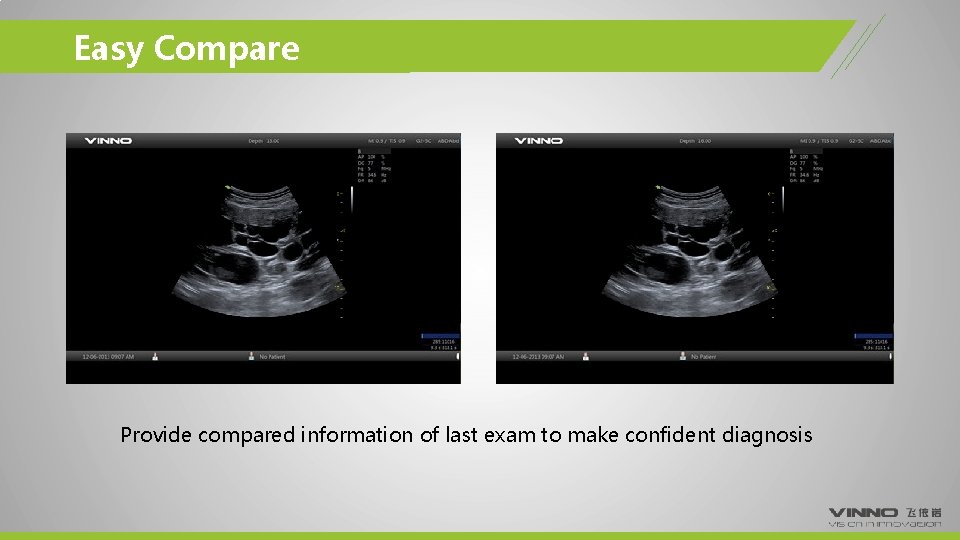 Easy Compare Provide compared information of last exam to make confident diagnosis 