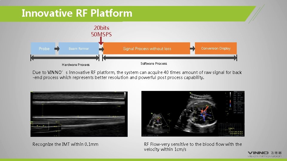 Innovative RF Platform 20 bits 50 MSPS Probe Beam former Hardware Process Signal Process