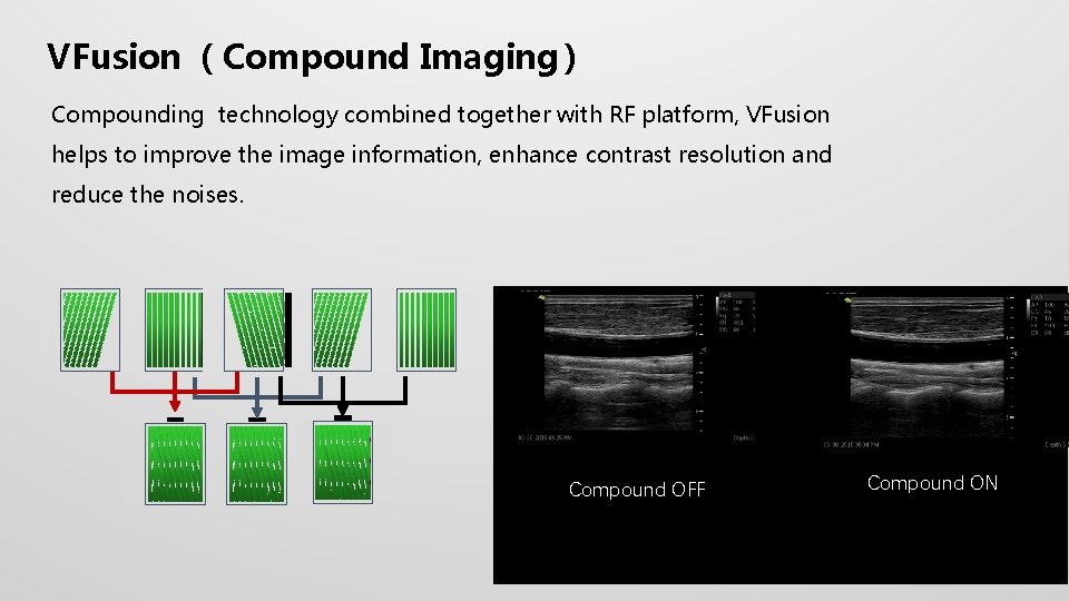 VFusion （Compound Imaging） Compounding technology combined together with RF platform, VFusion helps to improve